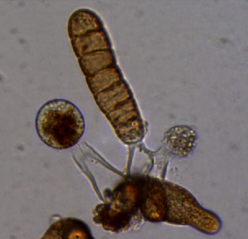 Microscopic photo of the development of three sporophytes growing out of a fertilized female gametophyte