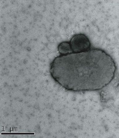 Halophilic symbionts attached to their host (from Hamm et al., 2019).