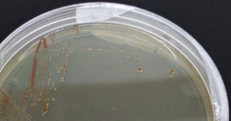Woeseia oceani XK5 – the sole cultivated member of the Woeseiales bacteria – forming colonies on a solid culture medium. Photo: Alena di Primio, NIOZ 
