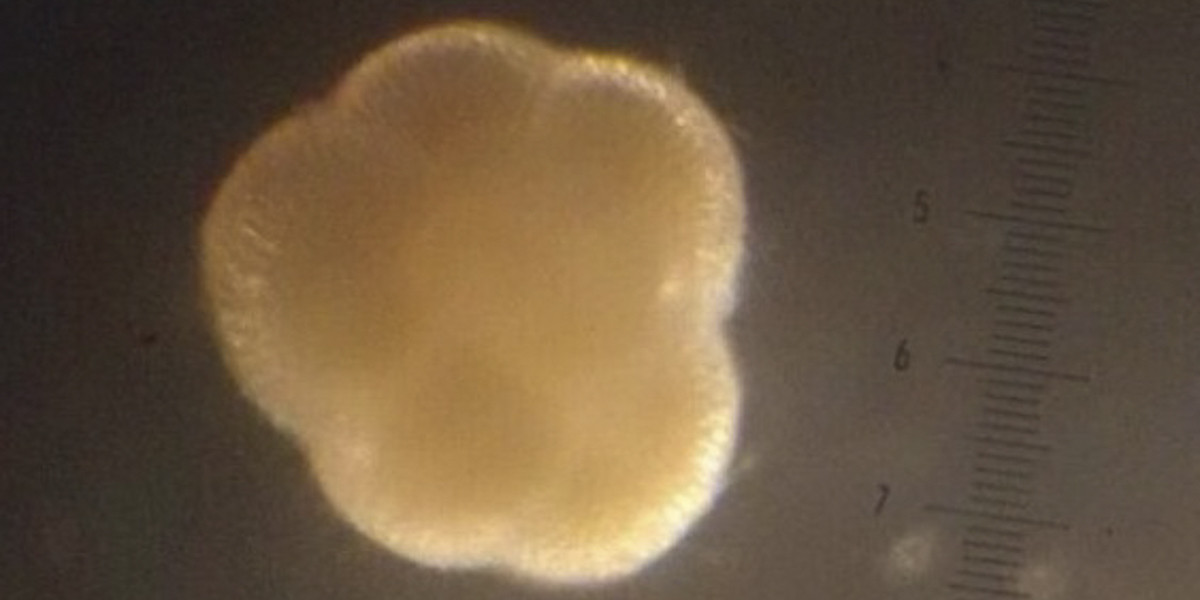 Foraminifera (photo: Lennart de Nooijer)