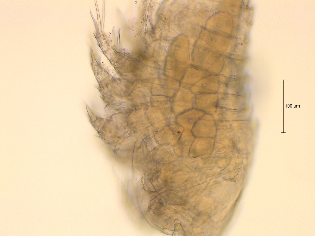 De inwendige eitjes maken deze Copepod bijzonder