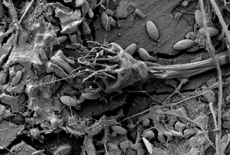 A variety of single-celled organisms make up the microbial reef seen here on a piece of plastic from the open ocean. Photo: Erik Zettler.