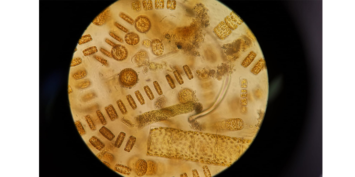 The beautiful view through a microscope. Photo: Robin Blonk. The beautiful view through a microscope. Photo: Robin Blonk.