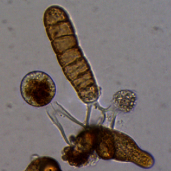 Development of three sporophytes growing out of a fertilized female gametophyte. Microscopic photo: Alexander Ebbing