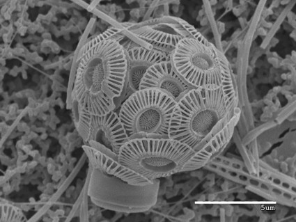 A coccosphere of Emiliania huxleyi, consisting of tiny plates called coccoliths