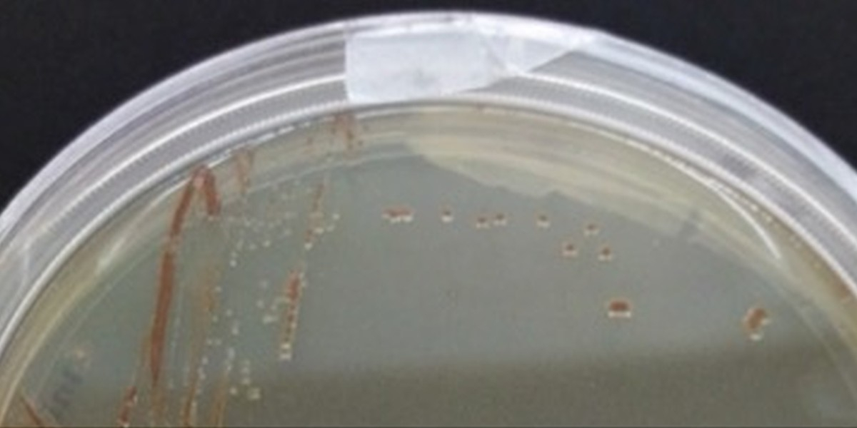 Colonies of Woeseia oceani XK5 on agar plates. Woeseia oceani XK5 is a cultivated representative of the order Woeseiales. Photo: Alena di Primio.