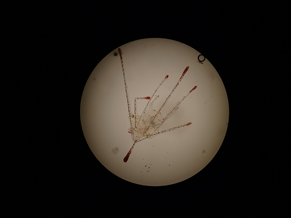 Sea urchin larva, photo: Jacco Kromkamp