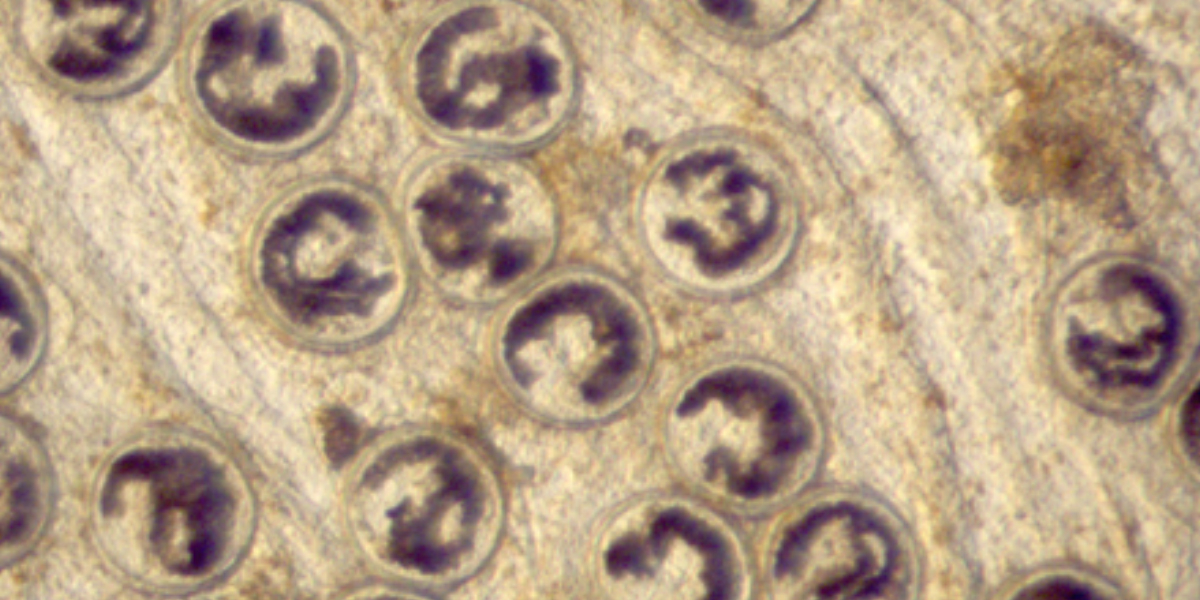 Complex life cycle | Trematode parasites (<I>Renicola roscovita</I>) encysted in a cockle which serves as second intermediate host. Periwinkles serve as 1st intermediate and birds as definitive host for this parasite species. Photo: David Thieltges