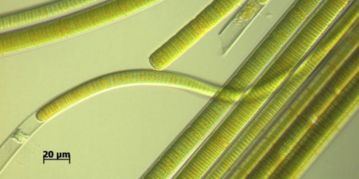 Lyngbya, cyanobacteria