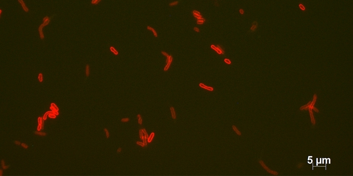 Fluorescent microscopy image of the bacteria Thermotoga maritima. The bacteria are stained to show their membrane in red. 5µm is 0,005 millimeter. Image: Diana Sahonero, NIOZ.