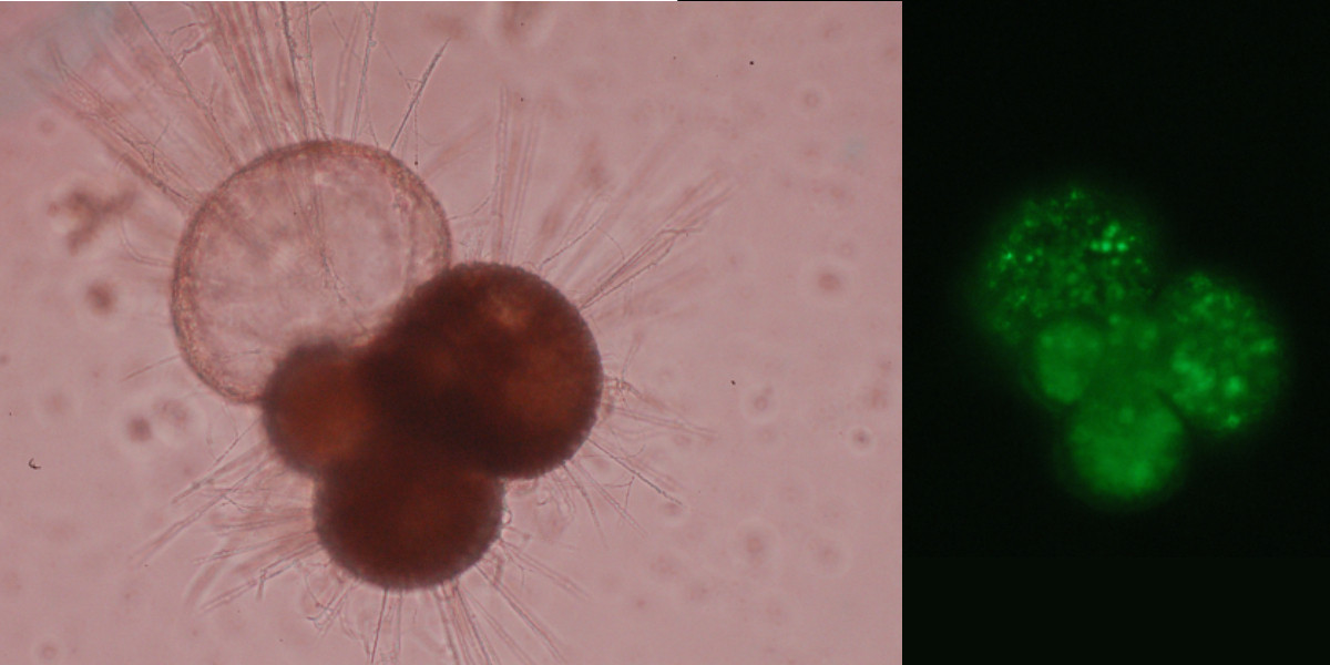 Microscopische foto's van foraminiferen.