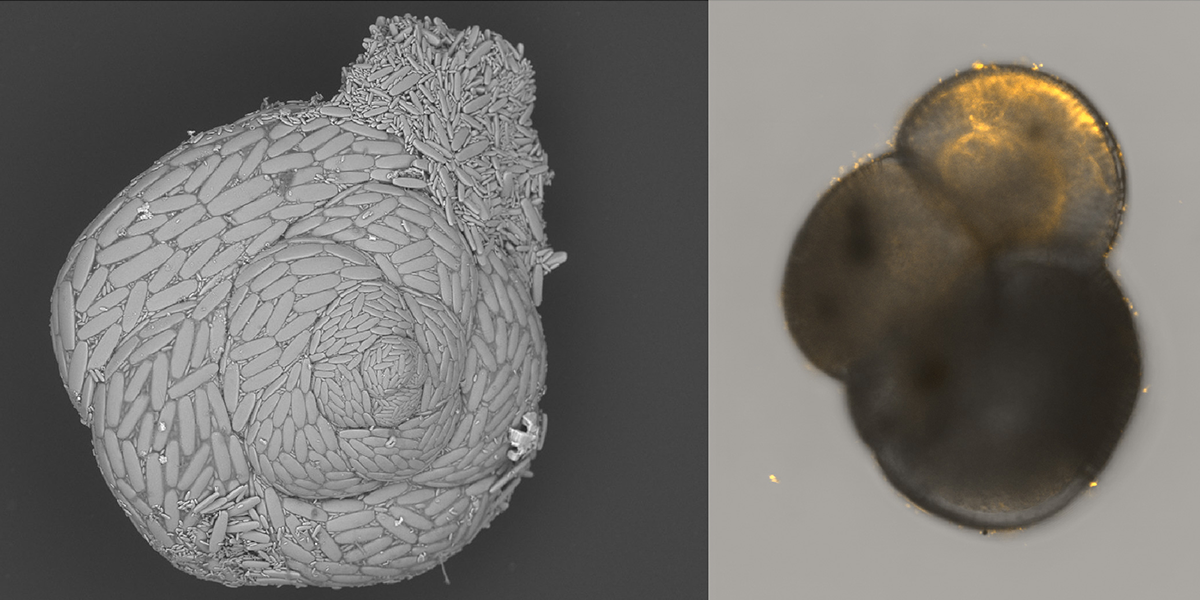 In this project we will study the calciumcarbonate produced by foraminifera (left) and the intracellular processes involved (right) using high-resolution confocal microscopy.