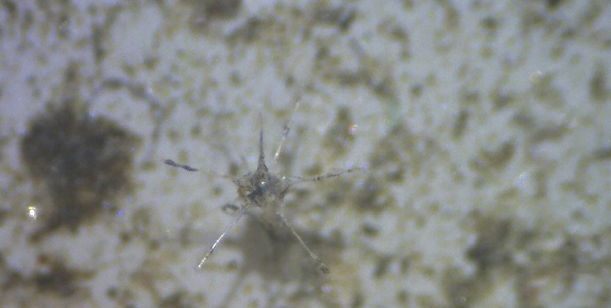 Little critters on the filter: a radiolarian (?)