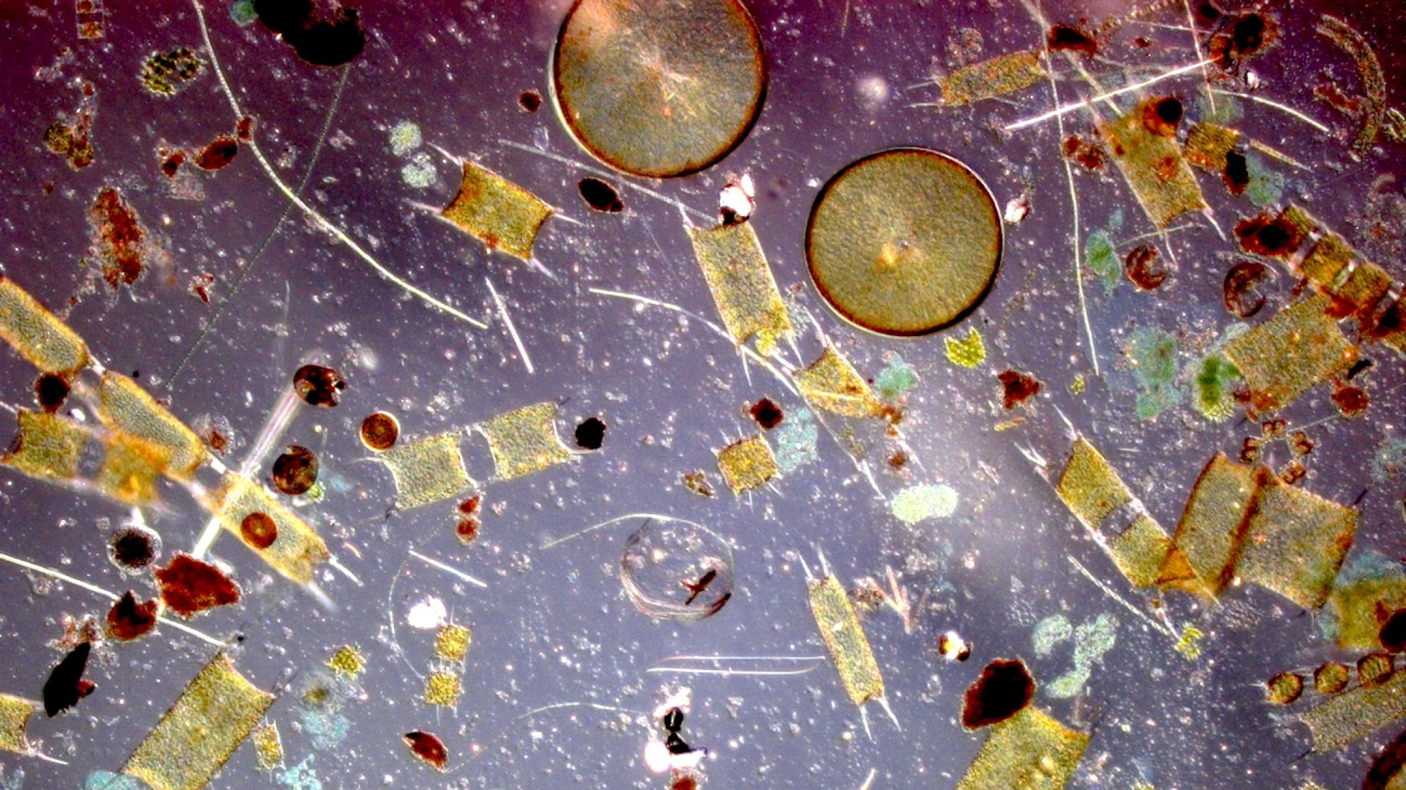 A microscopic image of algae, showing different semi-transparent shapes and figures on a blueish background. 