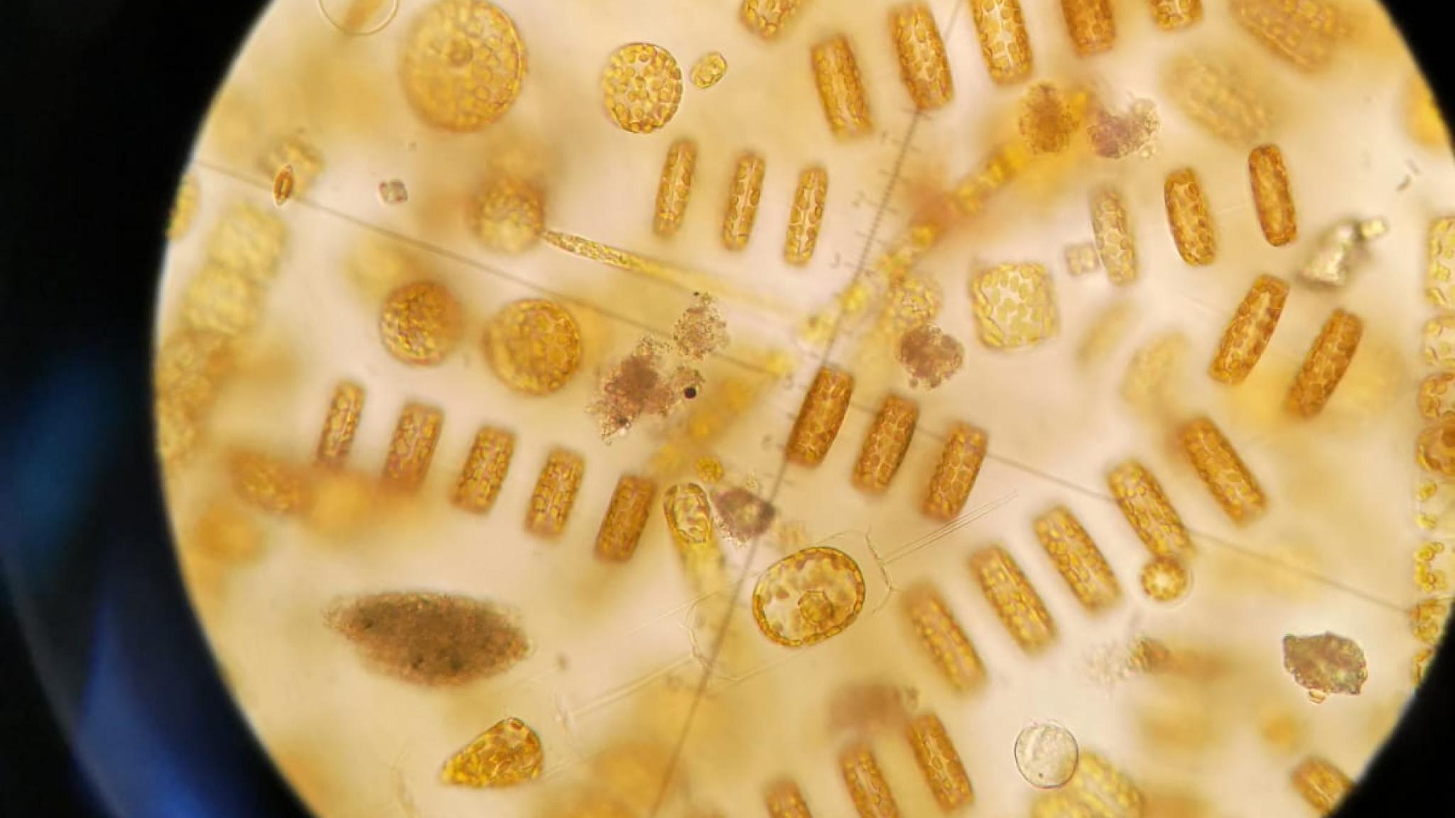 Phytoplankton under microscope (NIOZ)
