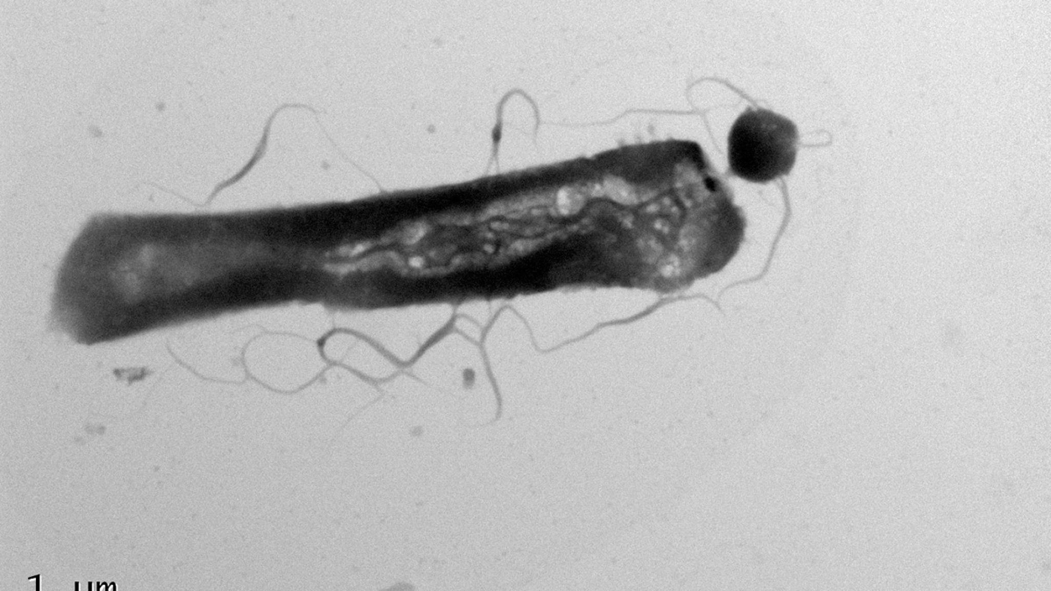 Microscopic image of a microbe with a parasite attached at one end.