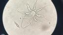 copepod under the microscope