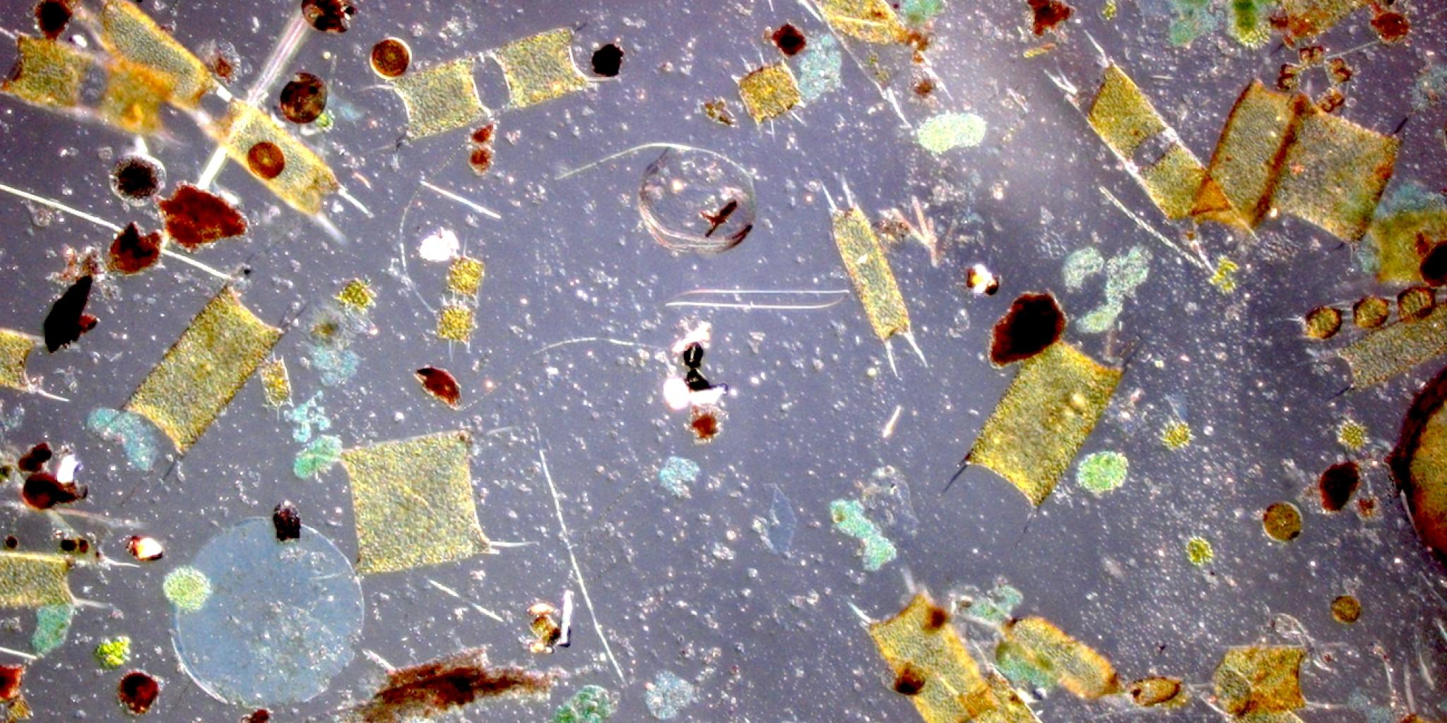 A microscopic image of algae, showing different semi-transparent shapes and figures on a blueish background.