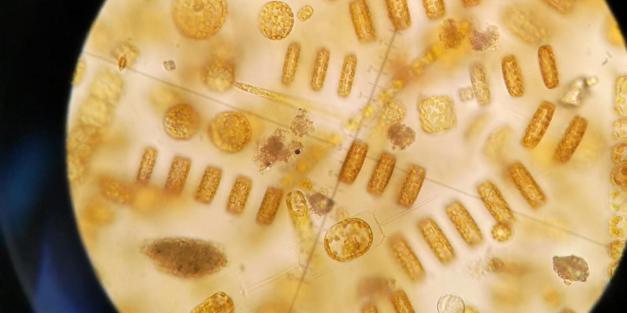 Fytoplankton onder microscoop (NIOZ)