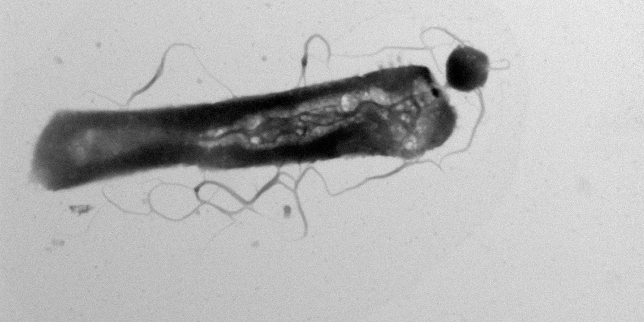 Microscopic image of a microbe with a parasite attached at one end.